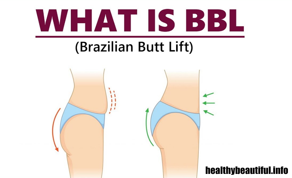 Power-Packed Brazilian Butt Lift Workout for Positive Results 2023