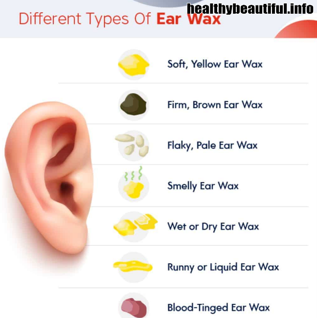 Ear Wax Meaning : A Definition and Types