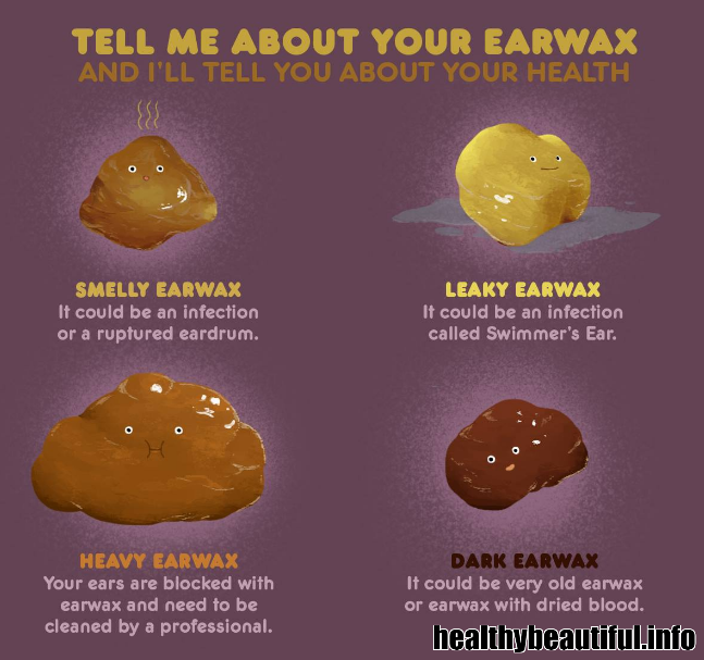 Signs of Heavy Ear Wax and How to Manage Them